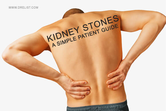 Kidney Stones | A Simple Patient Guide