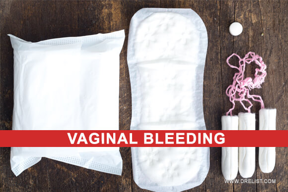 Vaginal Bleeding