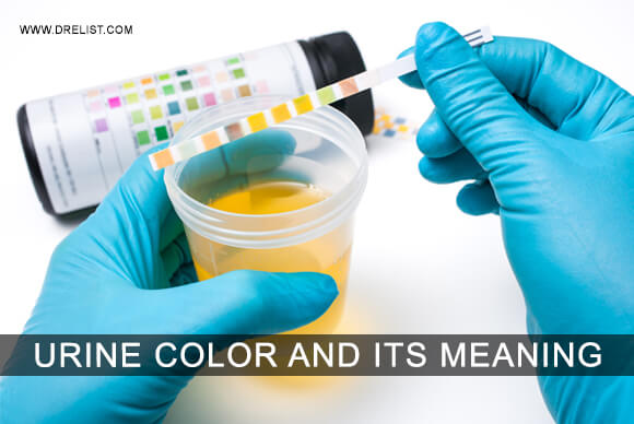 Urine Color and its Meaning