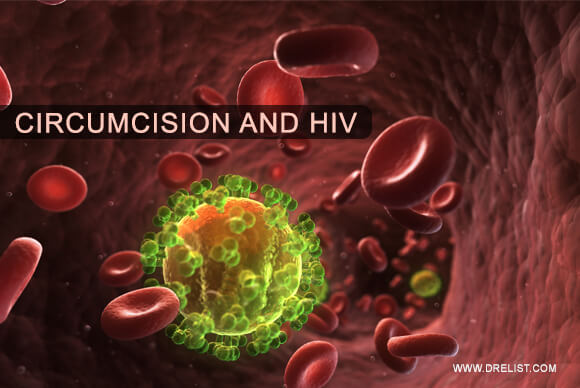 Circumcision And HIV