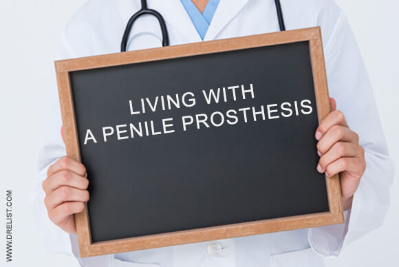Living With A Penile Prosthesis