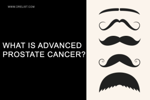 What is Advanced Prostate Cancer? image