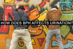 How Does BPH affects Urination? image