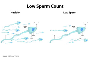Low Sperm Count image