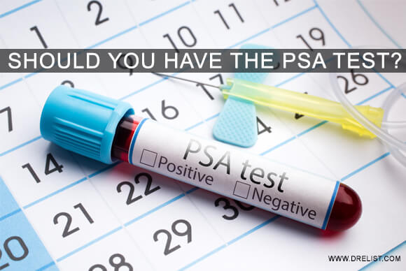 Should You Have The PSA Test?