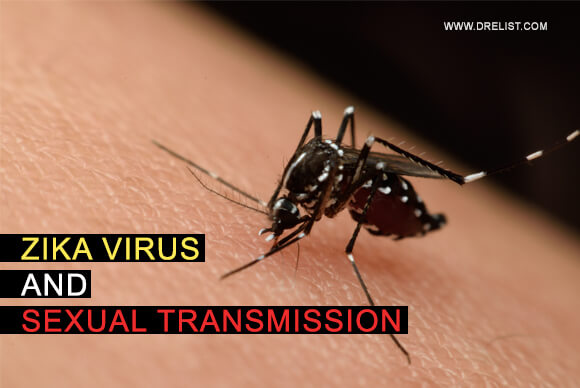 Zika Virus And Sexual Transmission