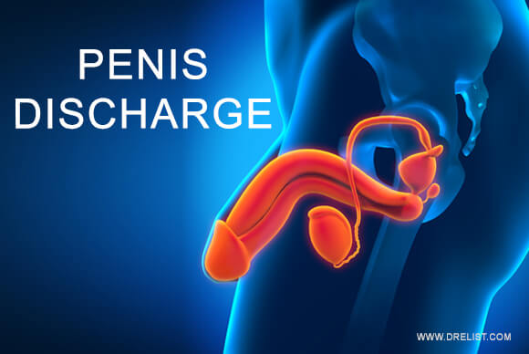 What Causes Penis Discharge?
