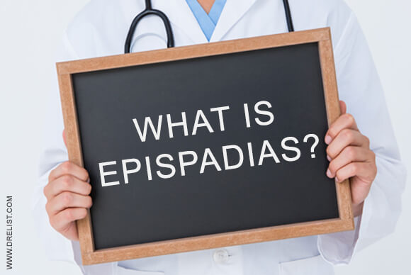 What Is Epispadias?