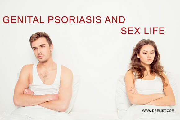 Genital Psoriasis And How It Affects Your Sex Life