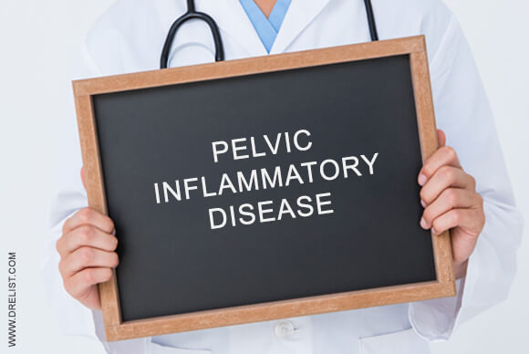 Pelvic Inflammatory Disease