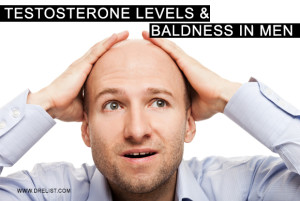 Testosterone Levels and Baldness In Men image