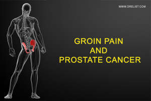 Groin Pain And Prostate Cancer image