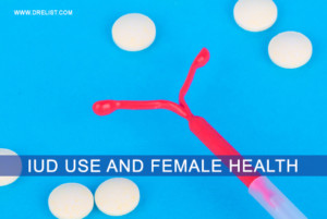 IUD Use And Female Health image