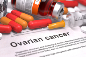 Ovarian Cancer image