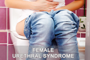 Female Urethral Syndrome Image