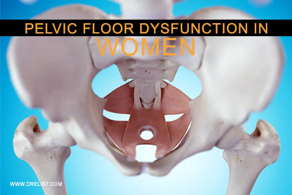 Pelvic Floor Dysfunction In Women