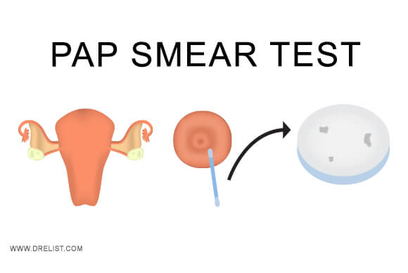 Pap Smear Test