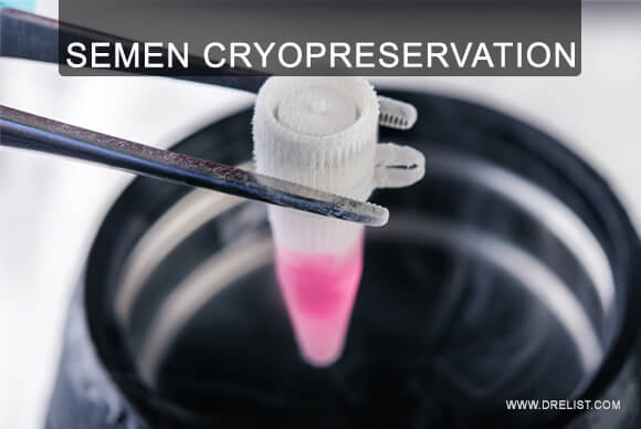 Semen Cryopreservation