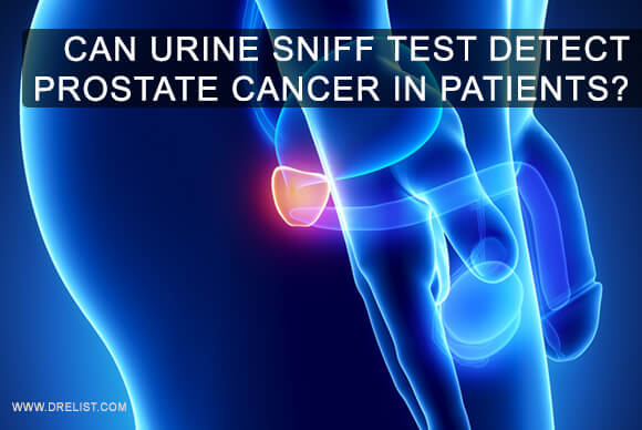 Can Urine Sniff Test Detect Prostate Cancer In Patients?
