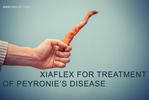 Xiaflex For Treatment Of Peyronie’s Disease