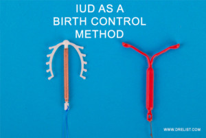 IUD As A Birth Control Method image