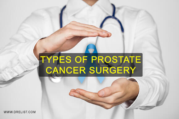Types Of Prostate Cancer Surgery