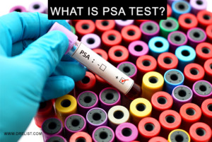 What Is PSA Test? Image