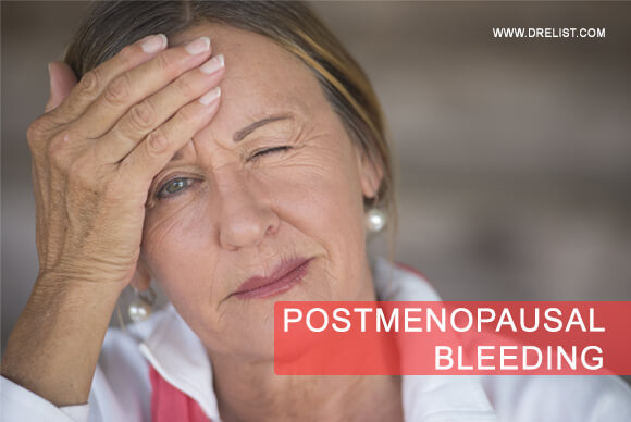 Postmenopausal Bleeding