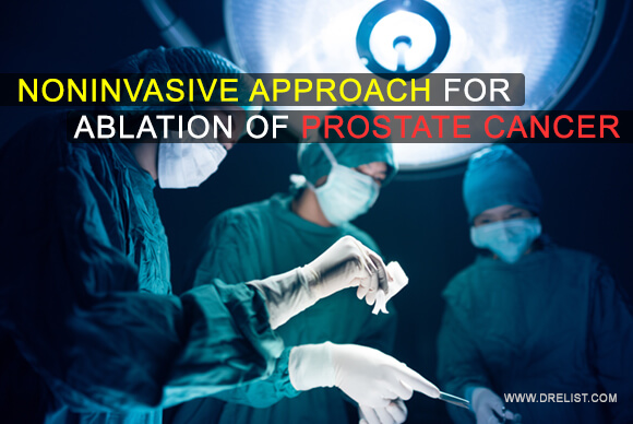 Noninvasive Approach For Ablation Of Prostate Cancer