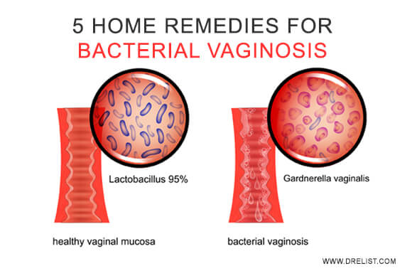 5 Home Remedies For Bacterial Vaginosis