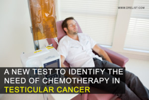 A New Test To Identify The Need Of Chemotherapy In Testicular Cancer Image