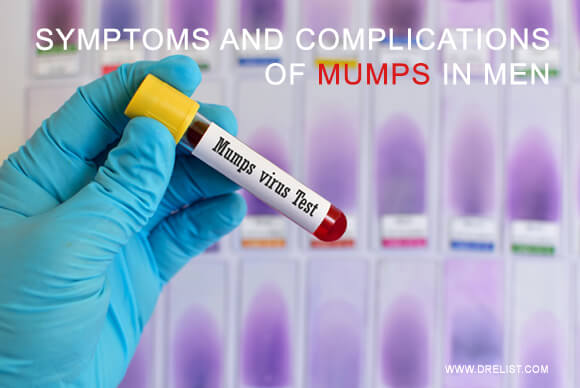 Symptoms And Complications Of Mumps In Men
