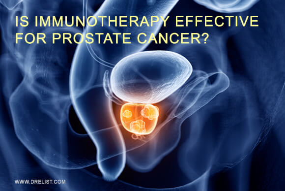 Is Immunotherapy Effective For Prostate Cancer?