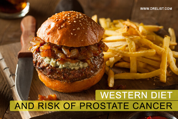 Western Diet And Risk Of Prostate Cancer