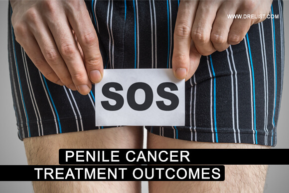 Penile Cancer And Treatment Outcomes