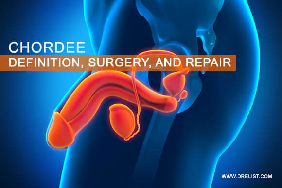 Chordee | Definition, Surgery, And Repair