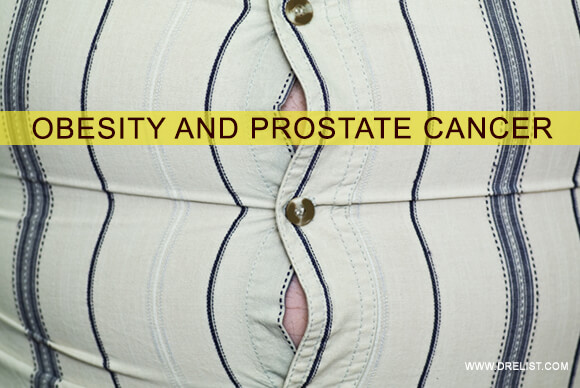 Obesity And Prostate Cancer – What Is The Association?