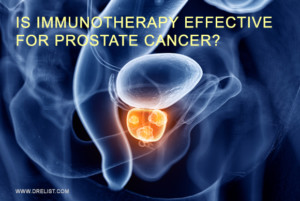 Is Immunotherapy Effective For Prostate Cancer? Image
