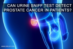 Can Urine Sniff Test Detect Prostate Cancer In Patients? Image
