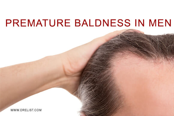 Premature Baldness In Men, Genetics And Risk Of Developing Prostate Disease