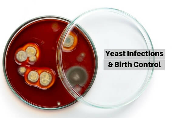Can Birth Control Cause Yeast Infection