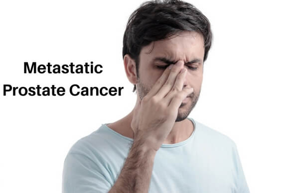 Metastatic Prostate Cancer