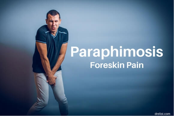 Paraphimosis: Symptoms, Treatment, and Prevention