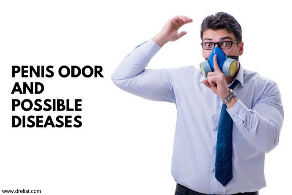 Penis odor and possible diseases