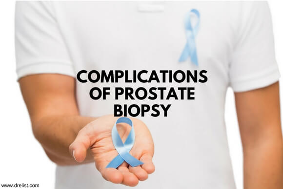 Complications of Prostate Biopsy