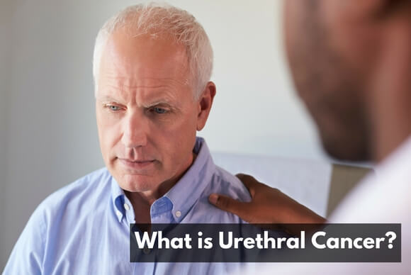 What Is Urethra Cancer