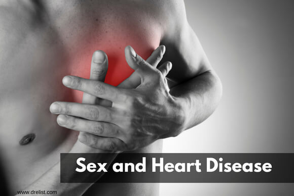 Sex and Heart Disease