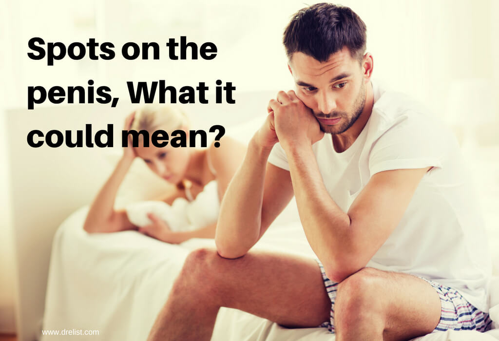 Spots on the penis, What it could mean?