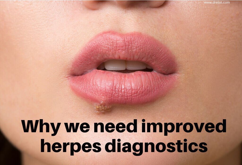 Why we need improved herpes diagnostics