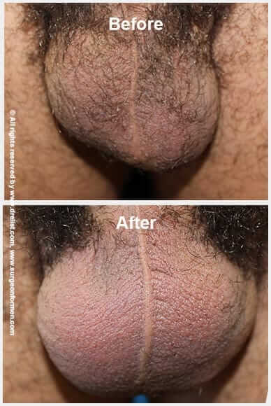 Before And After